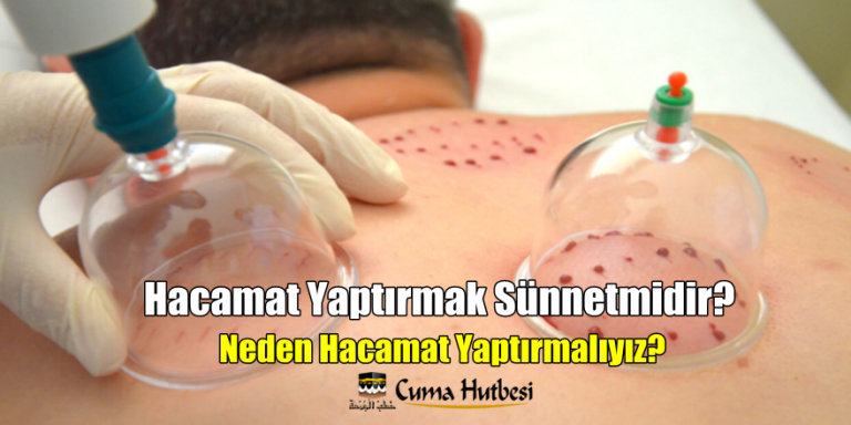 Hacamat Sünnet’midir? Neden Hacamat Yaptırmalıyız?